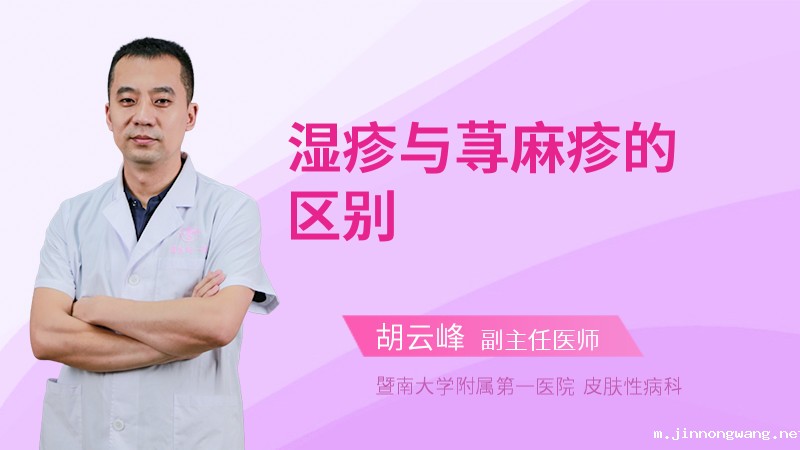 湿疹与荨麻疹的区别
