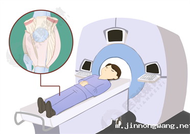 软组织MRI
